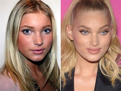 elsa hosk before and after